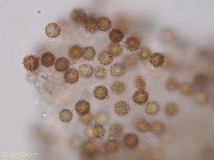 Octaviania asterosperma spores.jpg