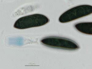 Rosellinia-corticium17.jpg