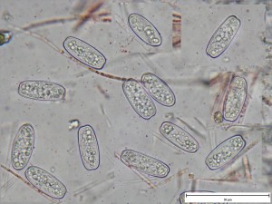 Sarcoscypha_spory.jpg